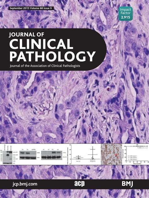 Procalcitonin Journal Of Clinical Pathology