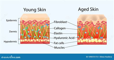 Vector Diagram With Schemes Of Two Types Of Skin For Healthcare