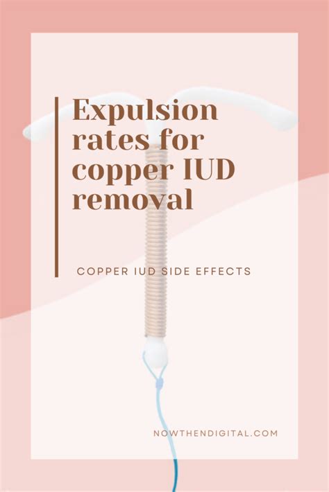 Removal Of Copper Iud When And What To Expect Now Then Digital