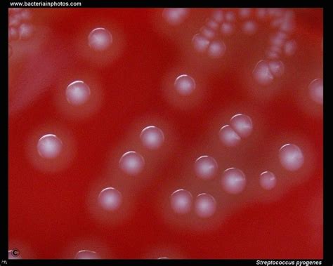 Streptococcus Pyogenes Colonies On Blood Agar Microbiology
