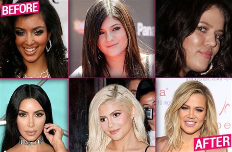 Kendall And Kylie Jenner Plastic Surgery Telegraph