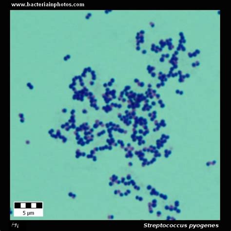Streptococcus Pyogenes Under Microscope Microscopy Of