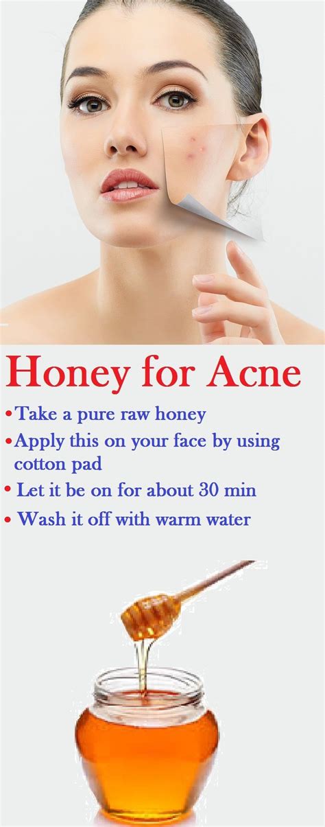 Putting Honey On Acne Tracsc