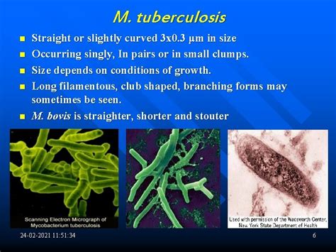 Mycobacterium Tuberculosis Introduction Mycobacteria They Are Slender