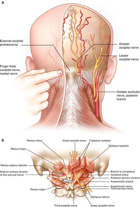 Stimulation Of The Peripheral Nervous System Occipital Techniques For