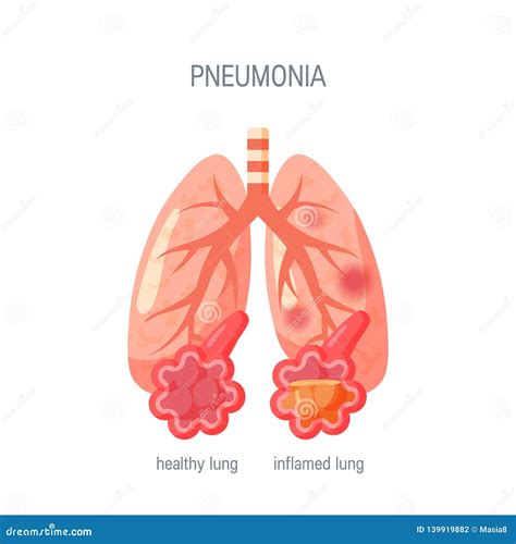 Pneumonia Disease Lungs Icon Realistic Style Cartoon Vector