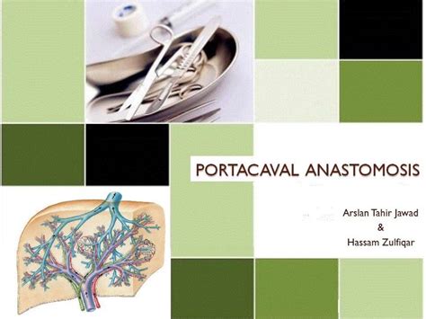 Portacaval Anastomosis