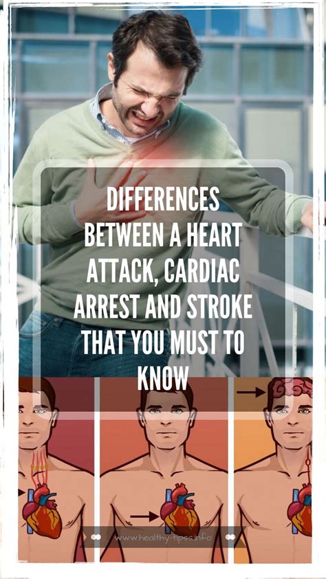 Differences Between A Heart Attack Cardiac Arrest And Stroke That You