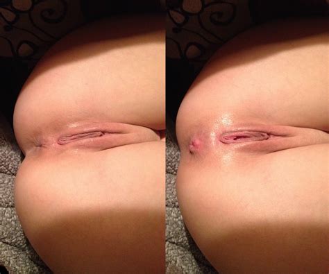 [f24] before after getting my holes fucked d porn pic eporner