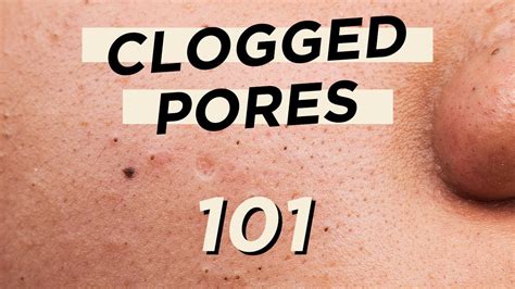 🤭everything You Need To Know About Clogged Pores • Skincare And Makeup