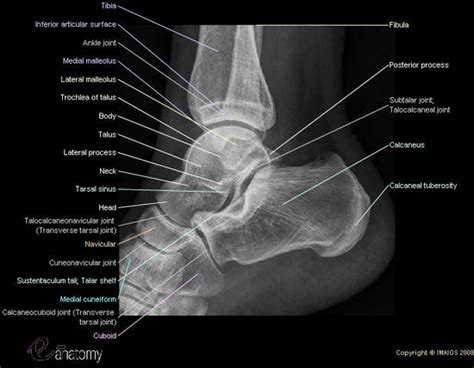 Ce4rt Radiographic Positioning Of The Heel And Ankle For X Ray Techs