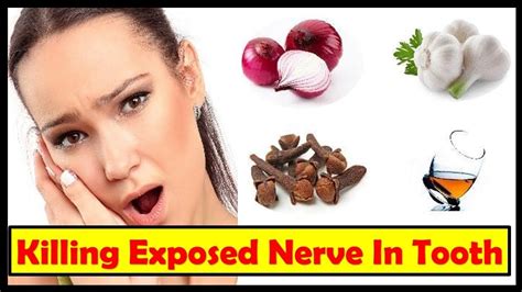 Toothache often comes and goes. Pin on Home Remedies For Killing Exposed Nerve in Tooth ...