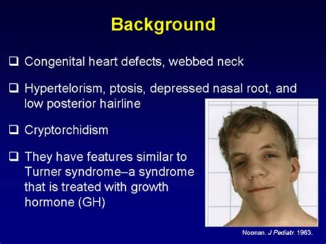 To Treat Or Not To Treat Short Stature In Noonan Syndrome Transcript