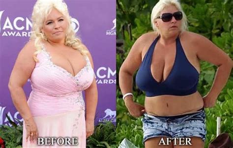 did beth chapman have plastic surgery before and after photos