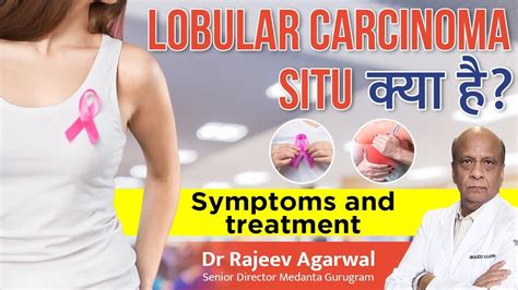 🤷🏻‍♀️lobular Carcinoma Situ क्या है Lobular Carcinoma Symptom And