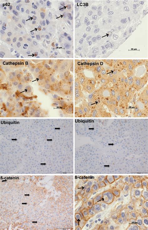 Immunohistochemical Analysis Of Catenin And Autophagy Associated Download Scientific Diagram