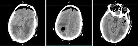 April 2022 Case Of The Month Doctor Fungus