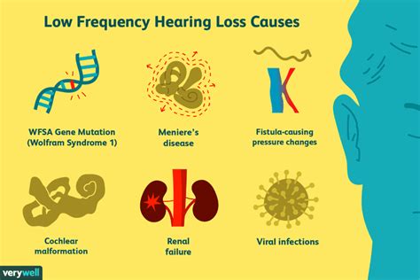 Low Frequency Hearing Loss Overview And More