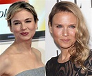 Renee Zellweger Before And After Plastic Surgery Pictures