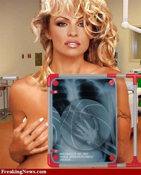 Celebrities Under X Rays Pics Izismile Com