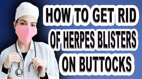 How To Get Rid Of Herpes Blister On Buttocks Youtube