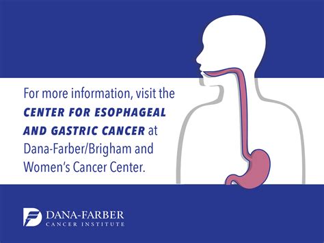 Signs And Symptoms Of Esophageal Cancer Dana Farber Cancer Institute