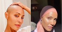 Alopecia femenina: por qué Jada Pinkett Smith se quedó calva