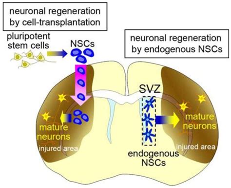 Therapeutic Strategies Using Exogenous And Endogenous Neural Stem Cells