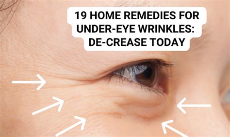 19 Home Remedies For Under Eye Wrinkles De Crease Today Skin Beauty