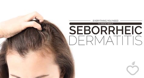 Everything You Need To Know About Seborrheic Dermatitis Positive Health Wellness