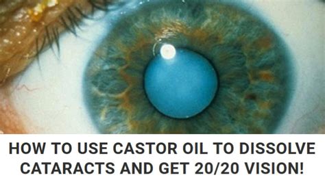 How To Use Castor Oil To Dissolve Cataracts And Get 20 20 Vision Youtube
