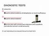 Can A Urinalysis Detect Diabetes Images