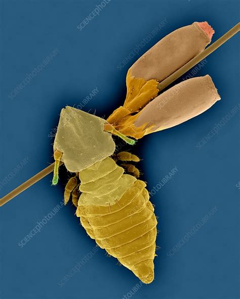 Cat Biting Louse And Egg Cases Sem Stock Image C0323575 Science