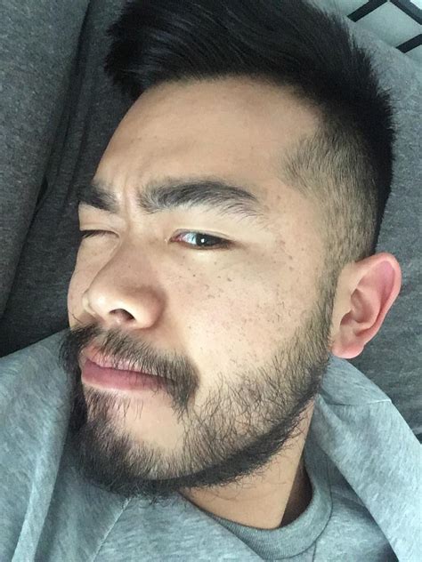 minoxidil beard asian