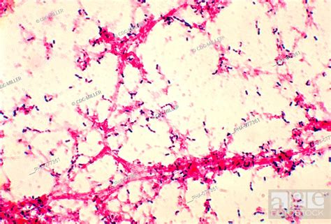 Photomicrograph Of Streptococcus Pneumoniae Bacteria This Gram