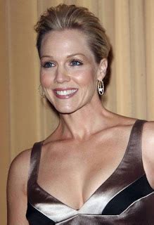 Jennie Garth Plastic Surgery Before And After Eyelid Botox And Facelift