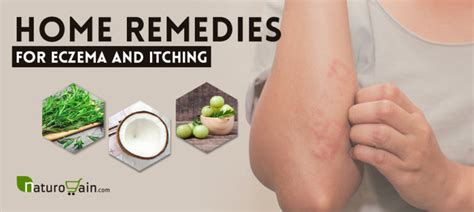 9 Effective And Best Home Remedies For Eczema That Work Naturally