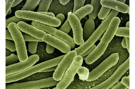 Scientists Discover How Superbug E Coli Clones Take Over Human Gut