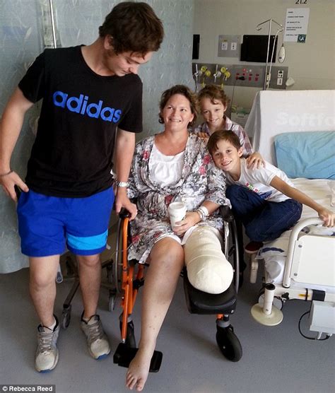 Mother Who Tripped On Back Step Breaking Her Ankle Has Leg Amputated
