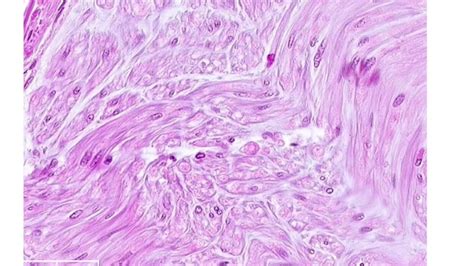 Histology Image Nervous Tissue