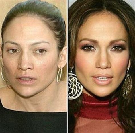 Jennifer Lopez Plastic Surgery Before And After Photos 2014 Celebs