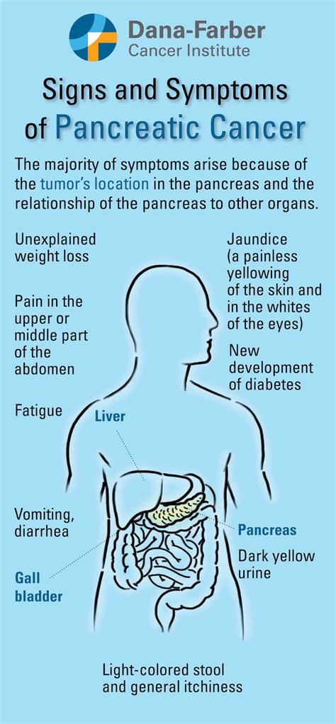 Pancreatic Cancer What Are The Signs And Symptoms Dana Farber