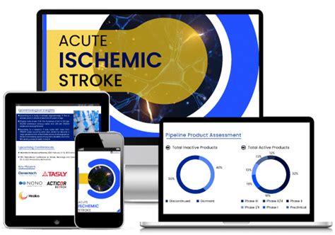 Acute Ischemic Stroke Ais Newsletter Acute Ischemic Stroke Ma