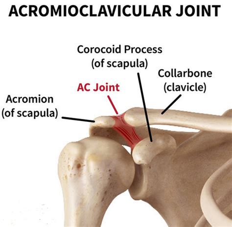 Collarbone Pain Clavicle Pain Causes And Treatment