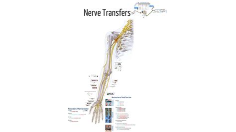 2012 Crn Acute Nerve Injury And Repair Nerve Transfers In The Hand