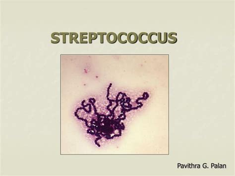 Ppt Streptococcus Powerpoint Presentation Free Download Id5596913