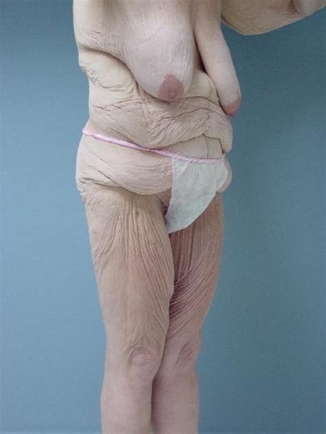 Older Grannies And Matures Showing Their Wrinkled Bodies Porn Pictures