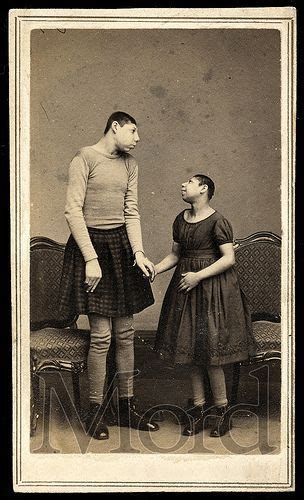 Sideshow Freaks Human Oddities Foto Real Vintage Circus Lewis