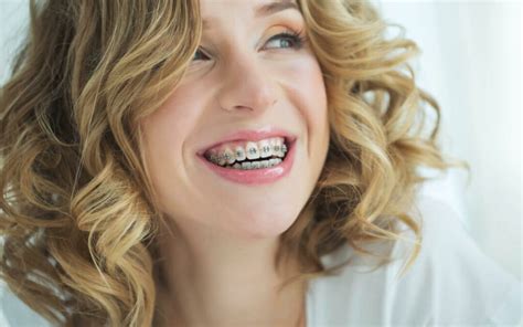 Myths About Getting Braces As An Adult Clements Orthodontics