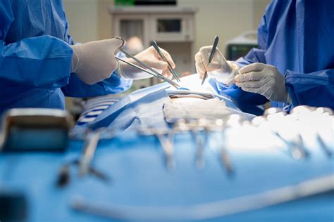 Como Funciona A Cirurgia Vascular Partmed A Maior Rede De Clínicas Médicas Do Brasil